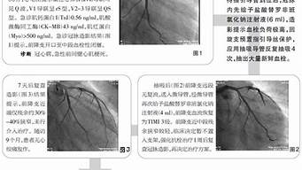 心臟血流timi3（心臟血流方向順序口訣）